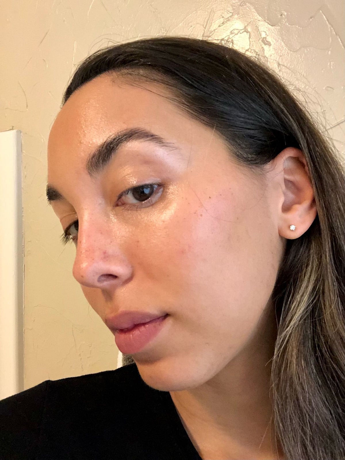 BP1121_PDP_before_after_olina_after_youthbomb_retinol_serum_1_WEB