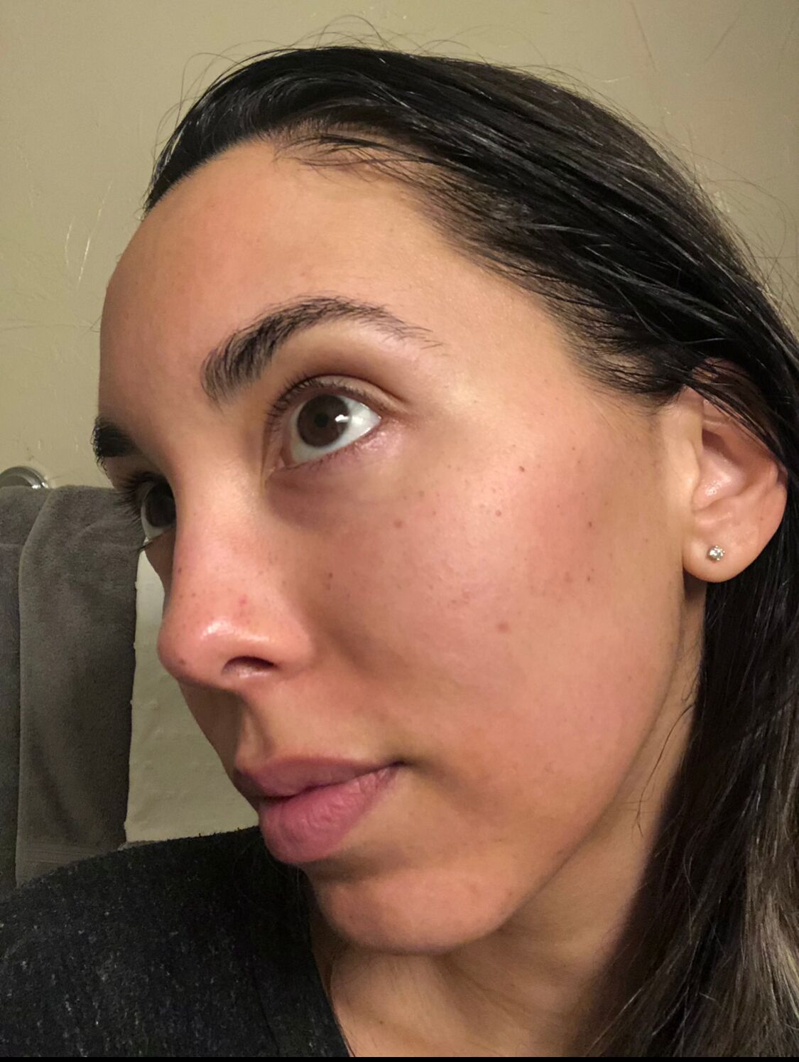 BP1121_PDP_before_after_olina_after_youthbomb_retinol_serum_2_WEB