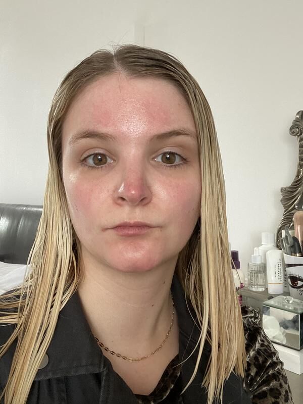 BP1121_PDP_before_after_sophie_before_plantastic_superdrops_2_WEB