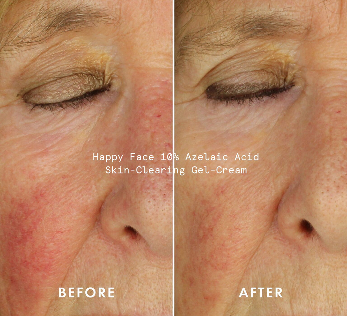 BP12340_moisturiser_landing_page_before_after_opt1_WEB
