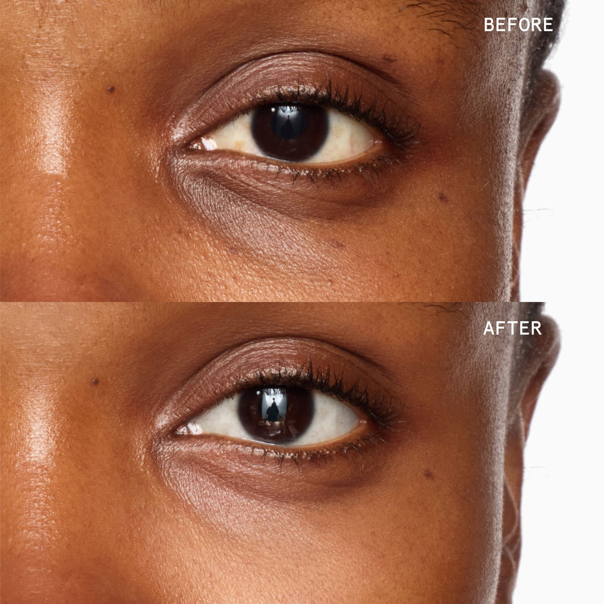 Superluminous Under-Eye Genius
