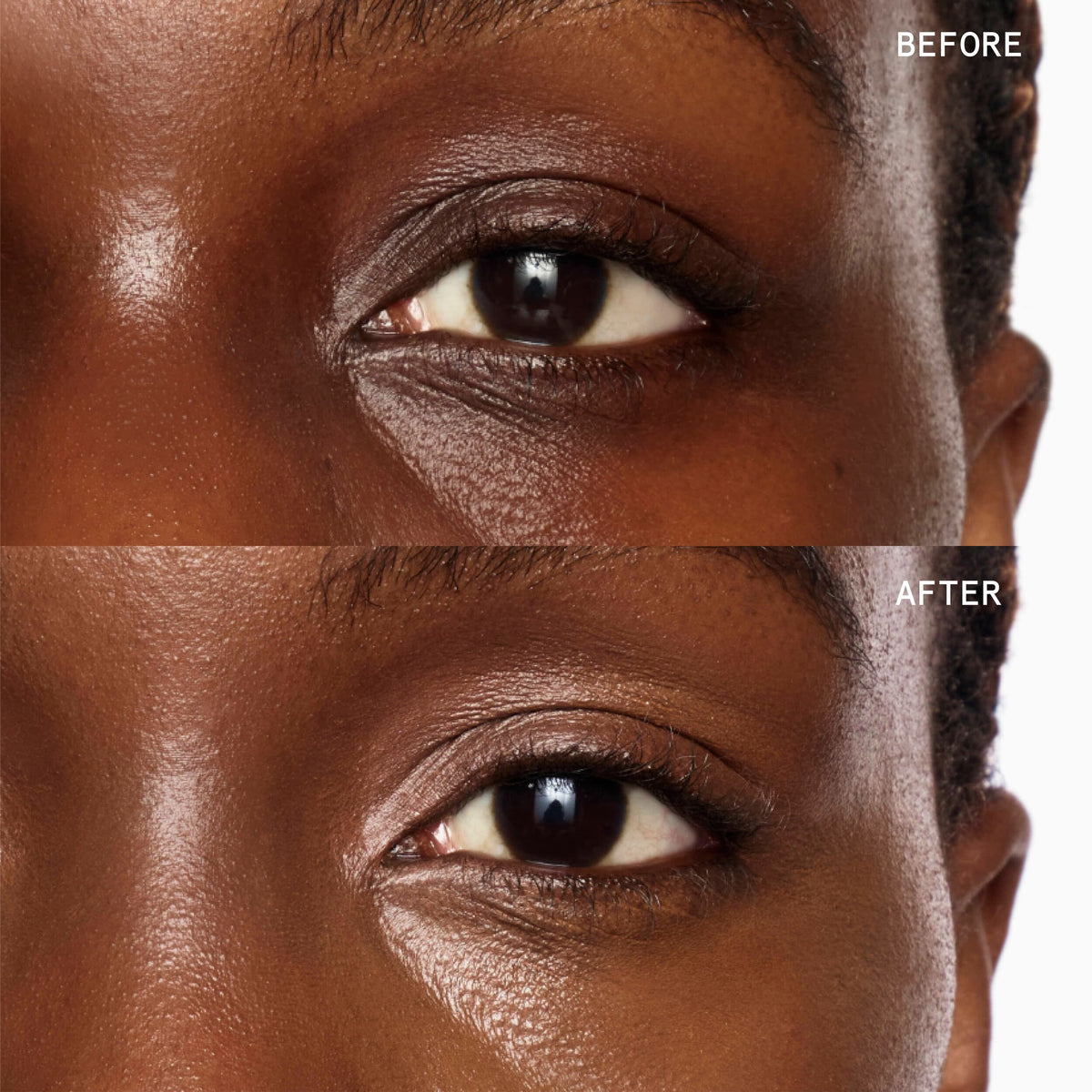 Superluminous Under-Eye Genius