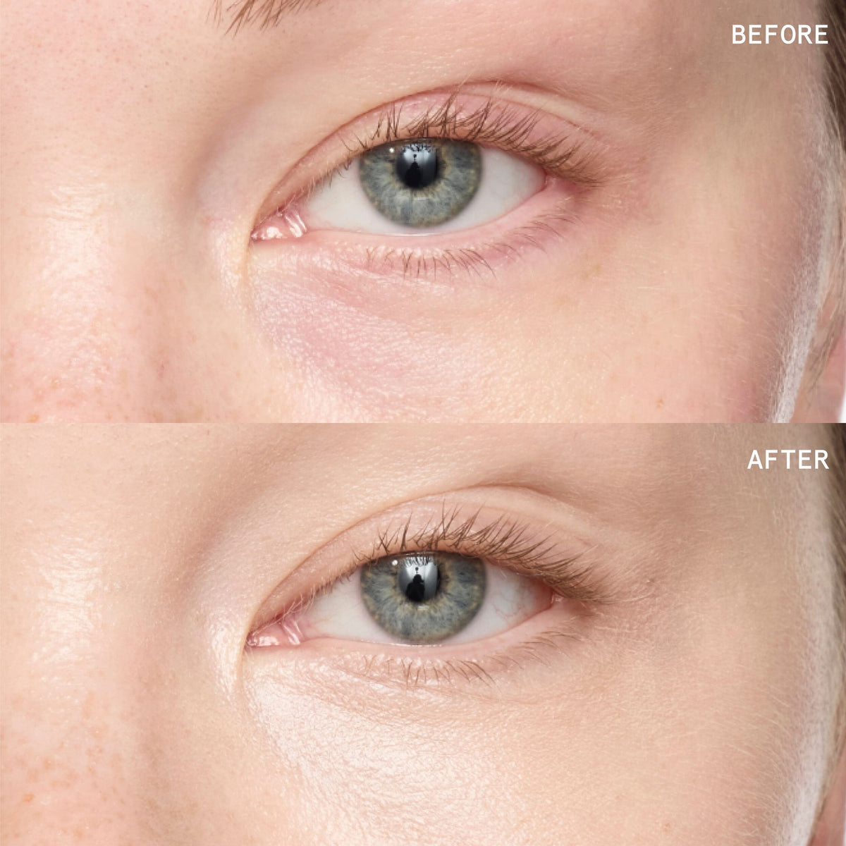 Superluminous Under-Eye Genius