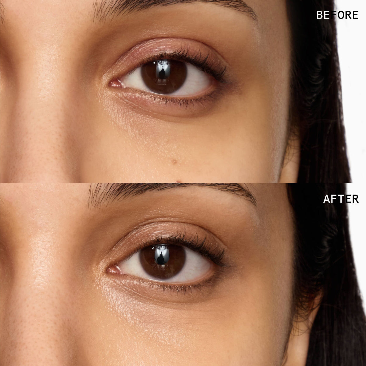 Superluminous Under-Eye Genius