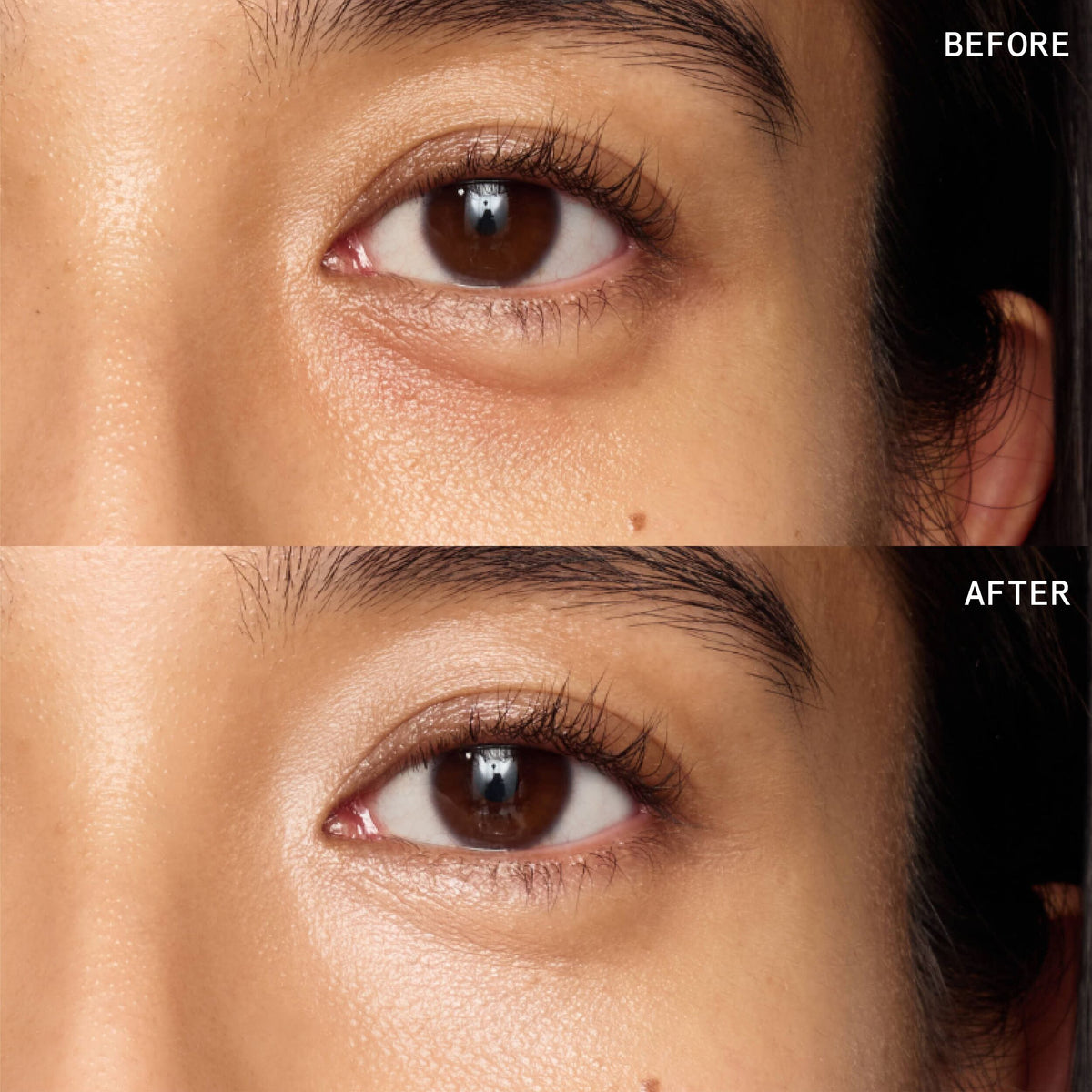 Superluminous Under-Eye Genius
