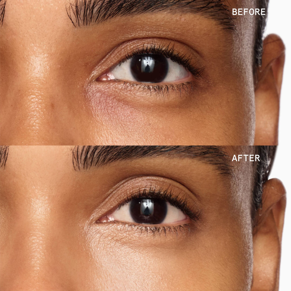 Superluminous Under-Eye Genius