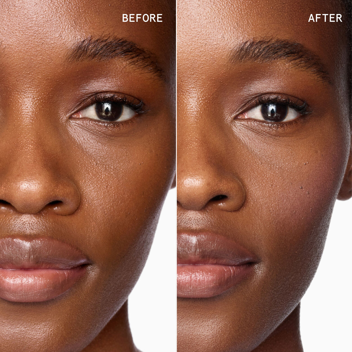 ERI - before/after