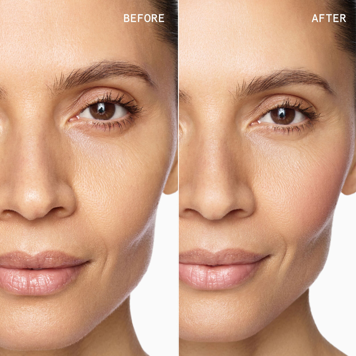 ERI - before/after
