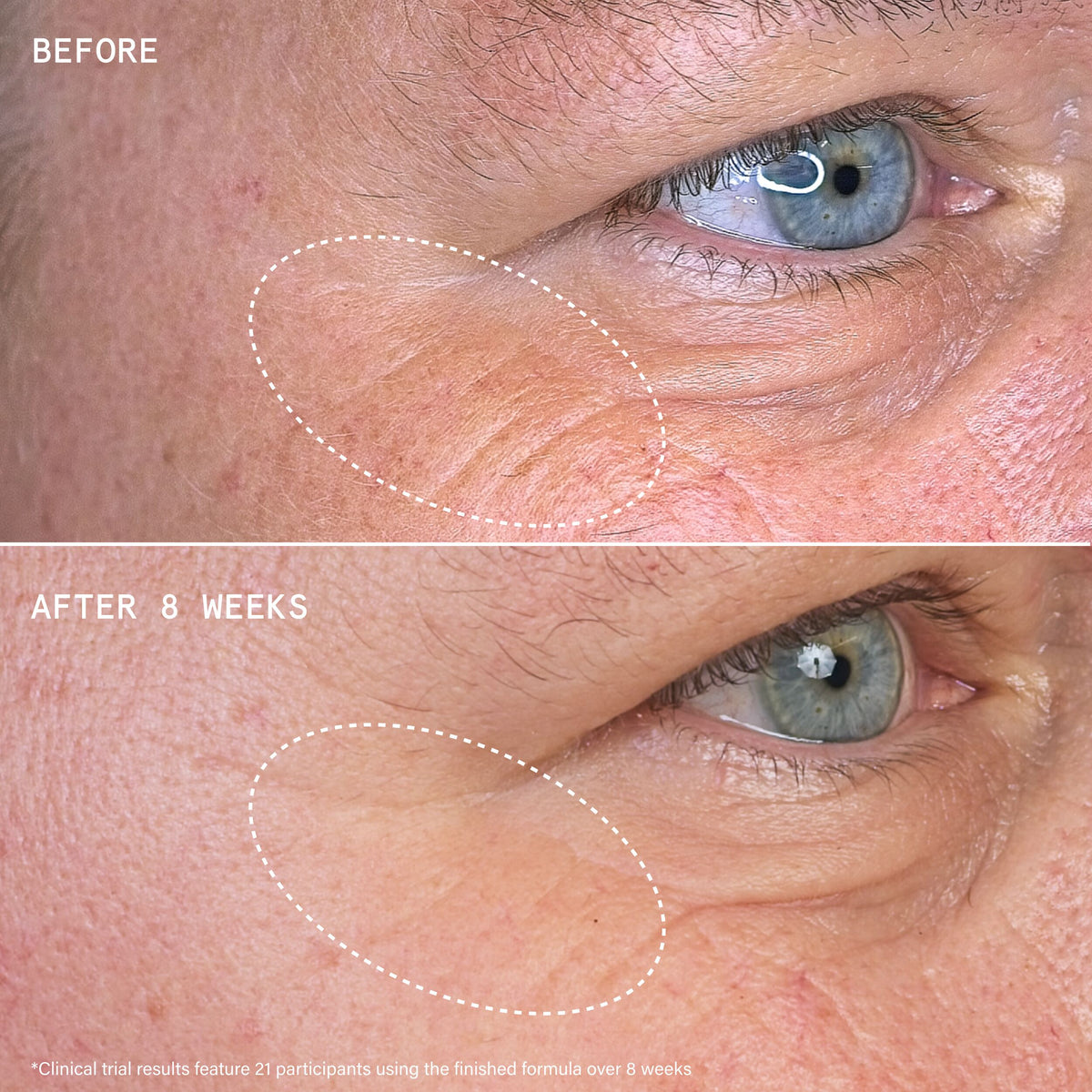 YB_360_MULTI_ACTION_EYE_REPAIR_NIGHT_SERUM_194833_PDP_ECOM_1x1_B&A_2026_WEB